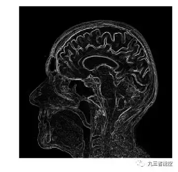算法集锦(5)|医学图像的边缘检测|Python_边缘检测方法分割医学图像图-CSDN博客