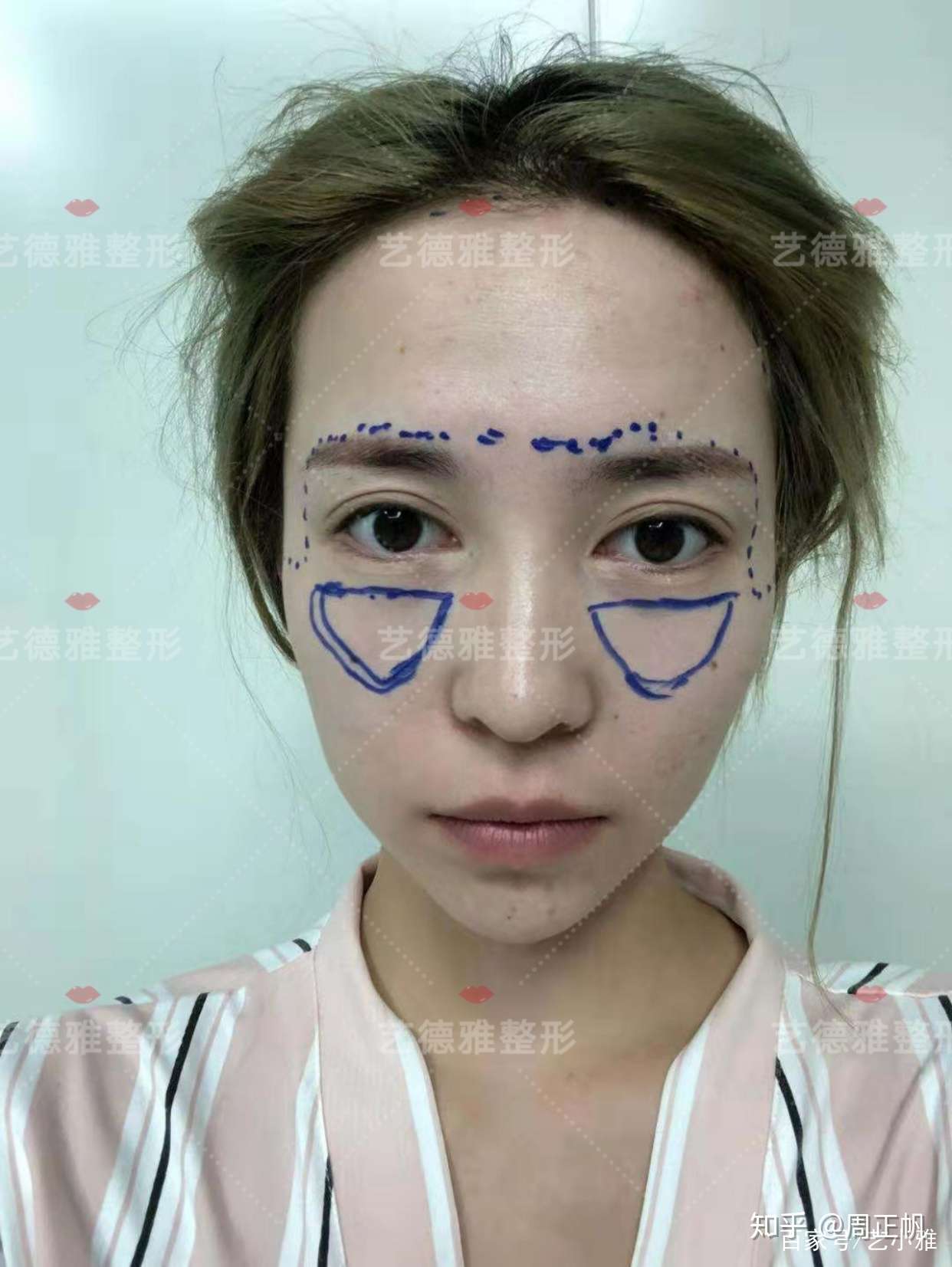 人生可以更美 鼻面综合平衡术 知乎