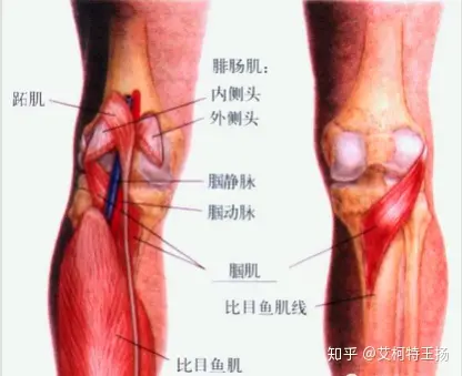 引起膝关节的疼痛腘肌天津艾柯特运动康复