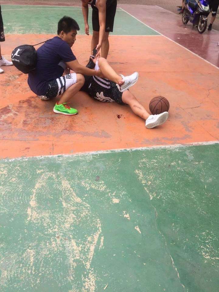 打篮球受过最严重的伤是什么?