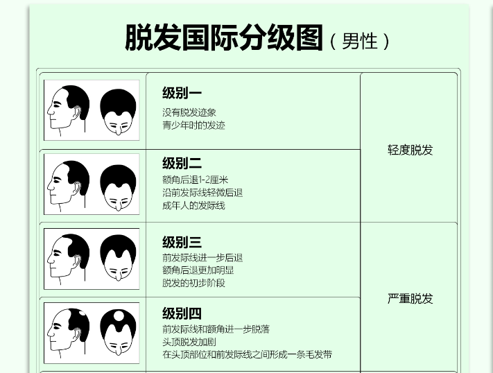 脱发国际分级图(男性)
