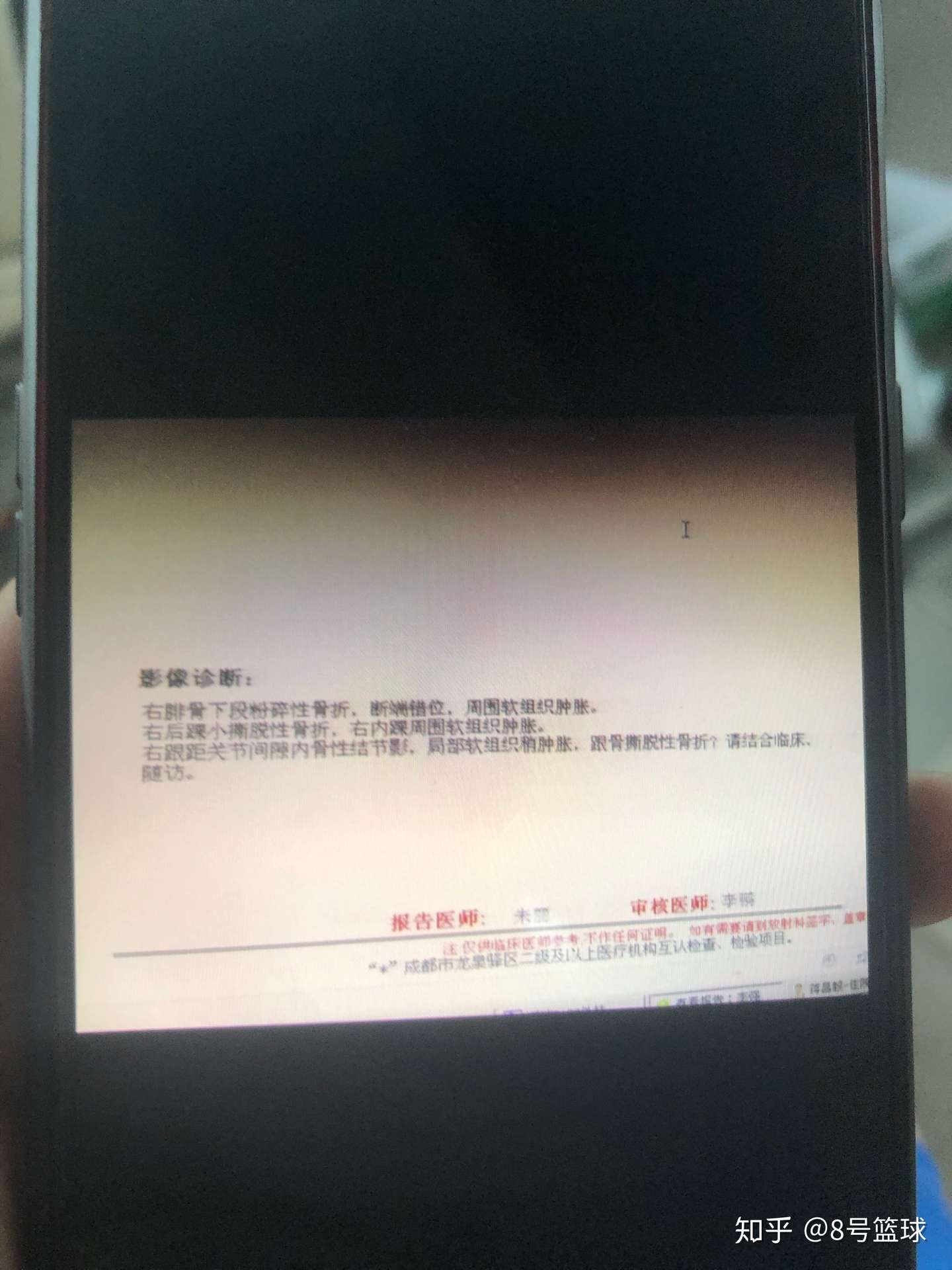 腓骨骨折漫长的恢复过程 知乎