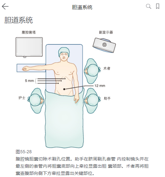 病例详解胆囊切除术 切除胆囊后会变得很胆小吗 知乎