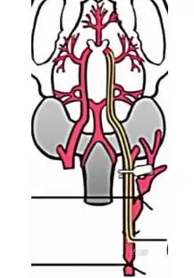 脑缺血再灌注模型-【动物造模】