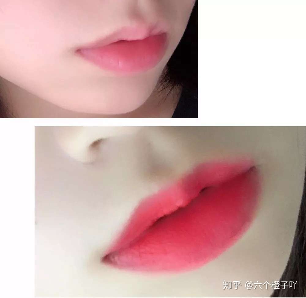 嘴唇干裂起皮 唇色深 怎么治愈看这里 知乎 嘴唇干裂起皮 唇色深 怎么治愈看这里 知乎