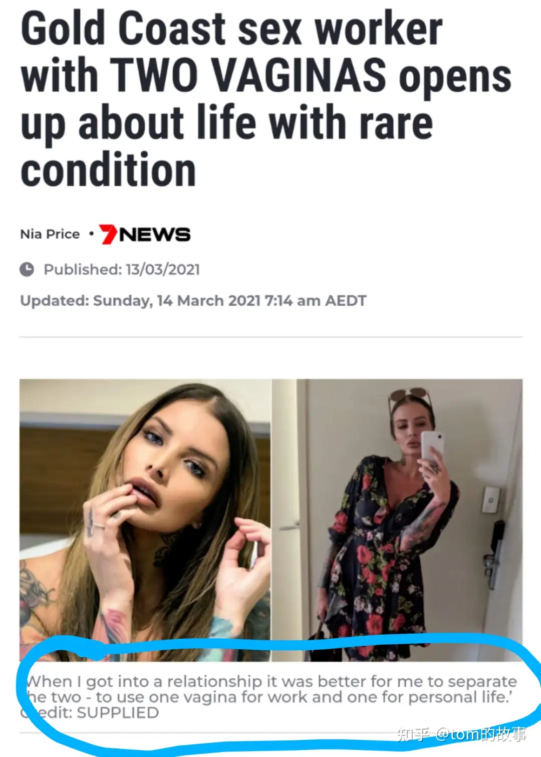女子惊现双阴道，一个接客，一个生活” - 知乎