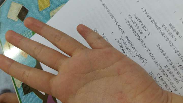 小手指短是一种什么体验?