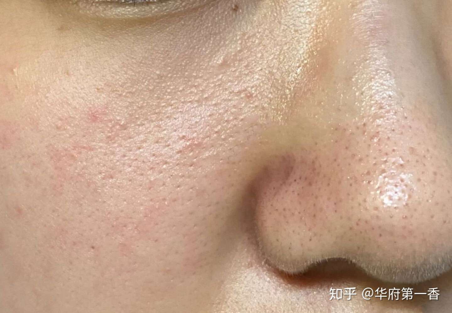 怎么把自己皮肤养的好好的 知乎