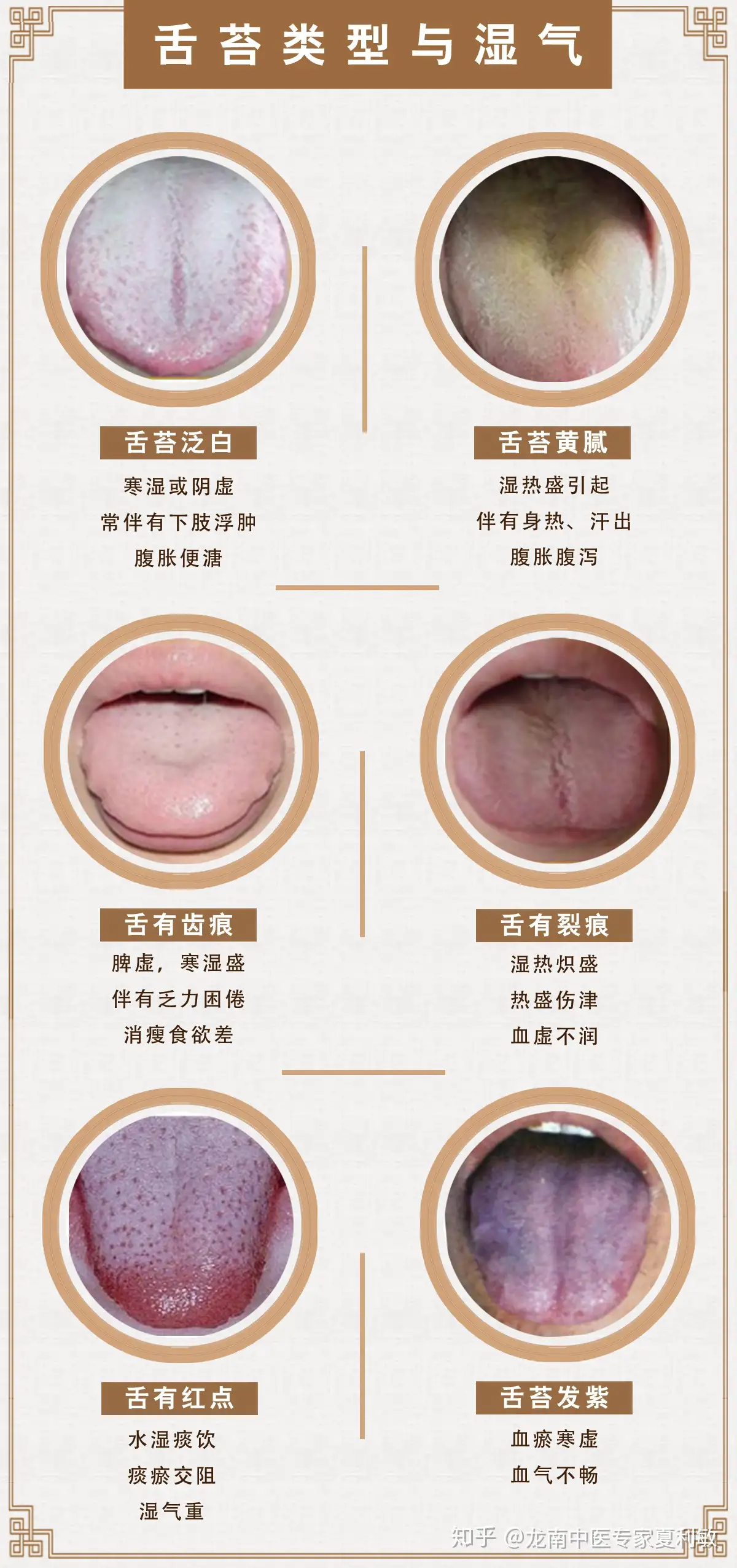 舌头上出现了齿痕，这是怎么回事？ - 知乎