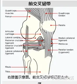 前交叉韌帶撕裂是最常見的膝關節損傷之一