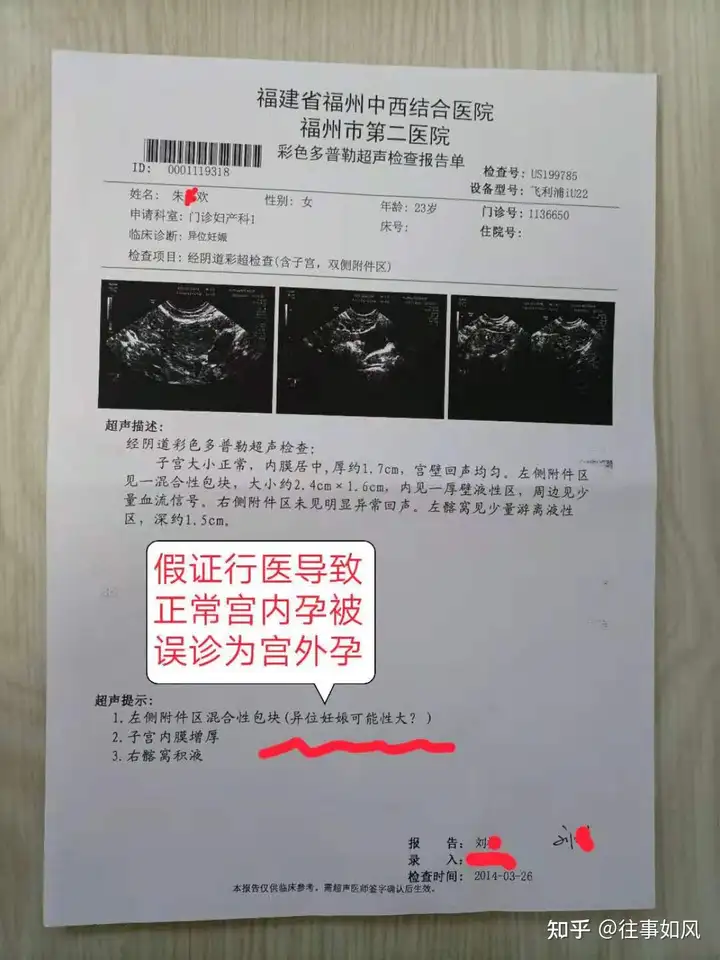 墙裂推荐（医院怀孕造假）如何去医院弄假的怀孕证明能不能被厂里查出 第3张