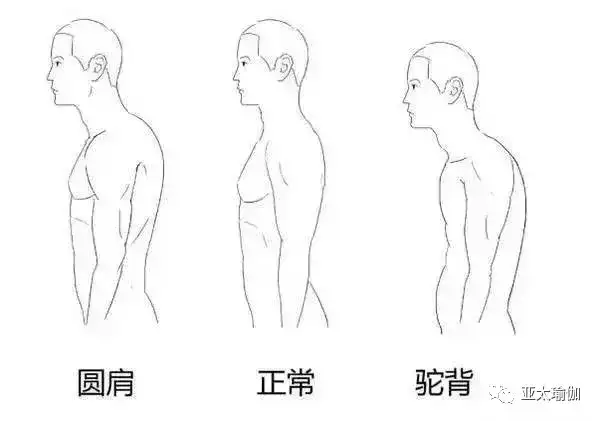 圆肩！驼背！怎么办？你离气质女神就差这篇推送！