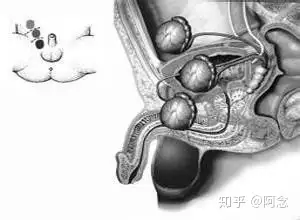 (二)多睾症无睾症极罕见,只单纯性无睾畸形,其内,外生殖器皆为男性性