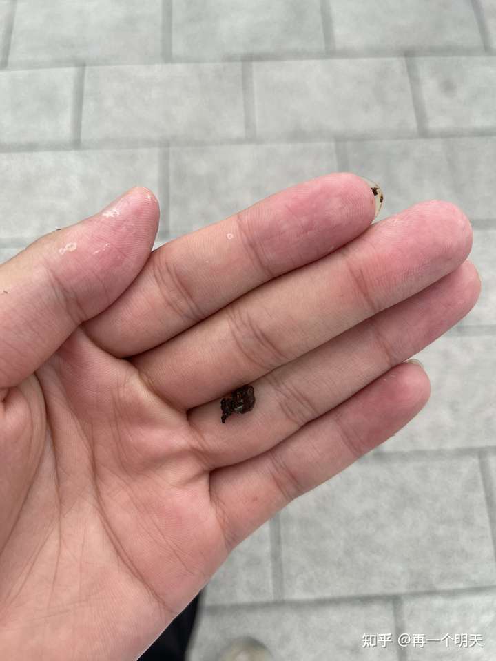 掏出一块超大耳屎,是种什么体验?