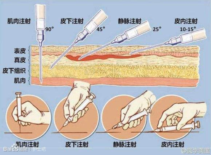 为什么现在屁股打针(肌肉注射)较少了?