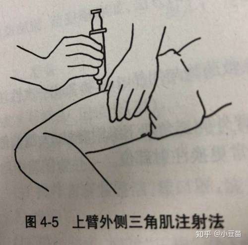 四价宫颈癌疫苗在身体哪个位置注射?