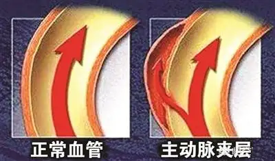 胸背疼痛首先排除这3大疾病死亡率极高专家说明白