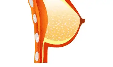 胸部在产后下垂的严重怎么办尝试这些方法