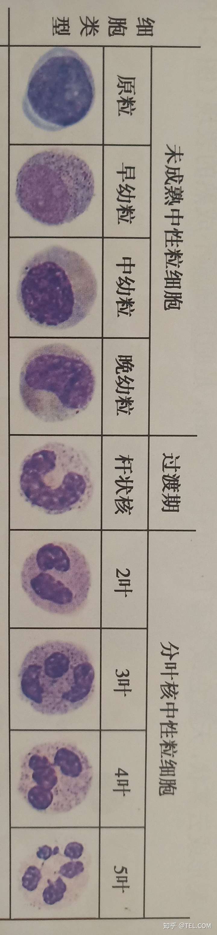 怎么分辨5种白细胞?