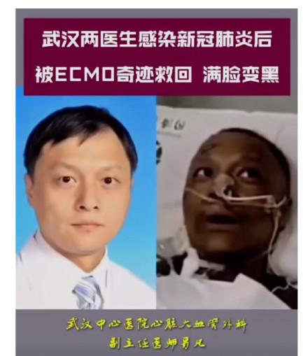 武汉的黑脸医生易凡又白回来了