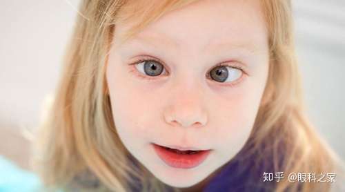 眼睛突然出现内斜,看东西重影,原来与看手机太多有关