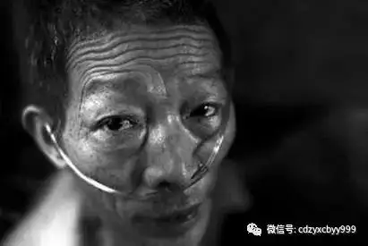 职业病九成是尘肺病跪着成为尘肺病人最后的姿态