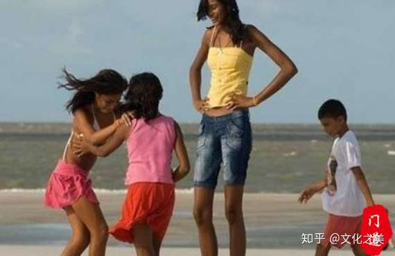 门道文化 科普 巨人症 成长的烦恼 知乎