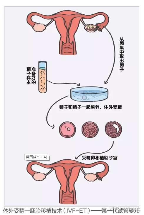 受精 体外 詳しく知りたい不妊治療：体外受精｜生殖医療科 杉山産婦人科
