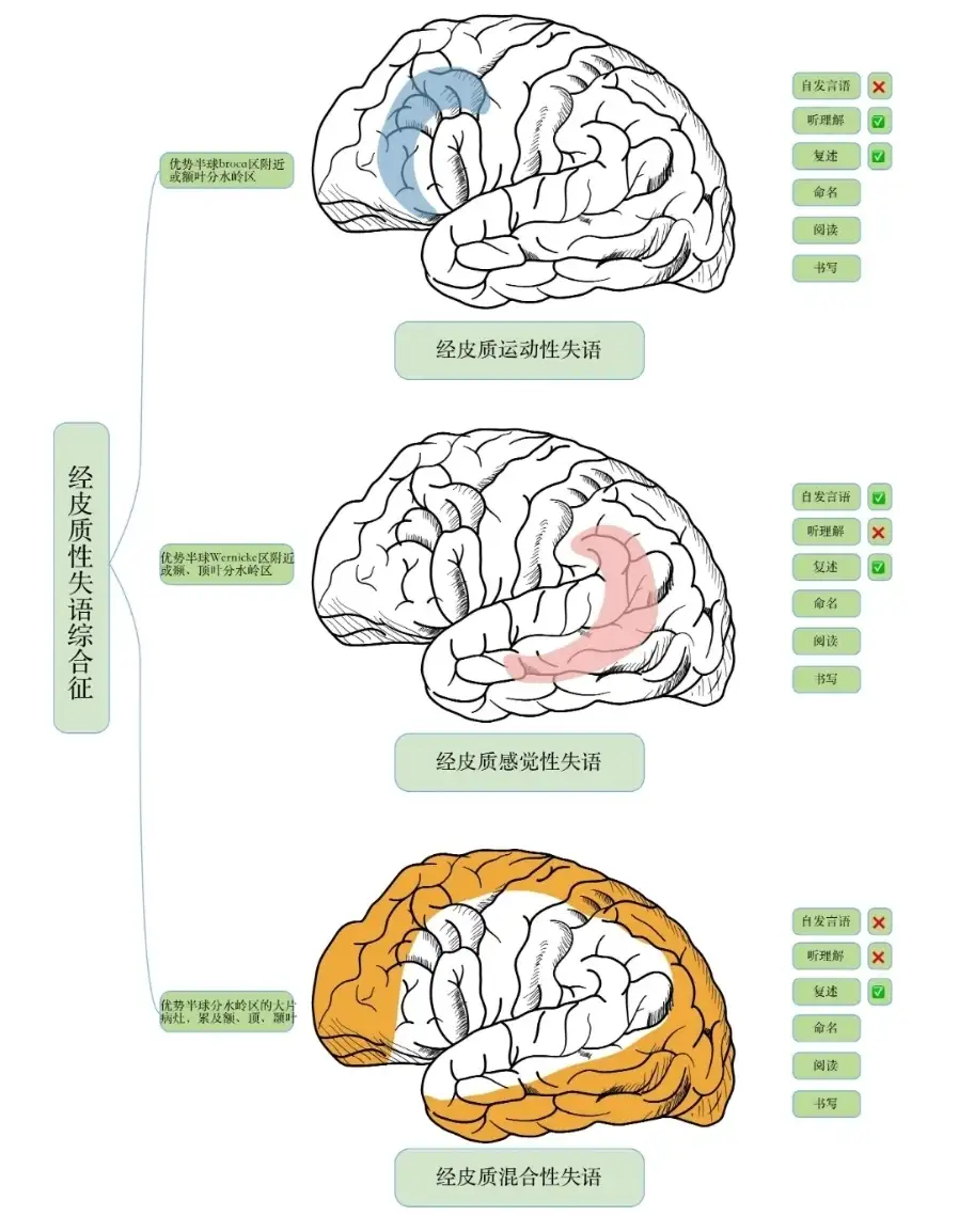 神内临床笔记41 了解失语这一篇就够啦- 知乎