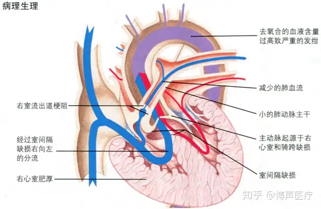 A01279717]摂食・嚥下障害のVF実践ガイド―一歩...+sma-laigle.fr