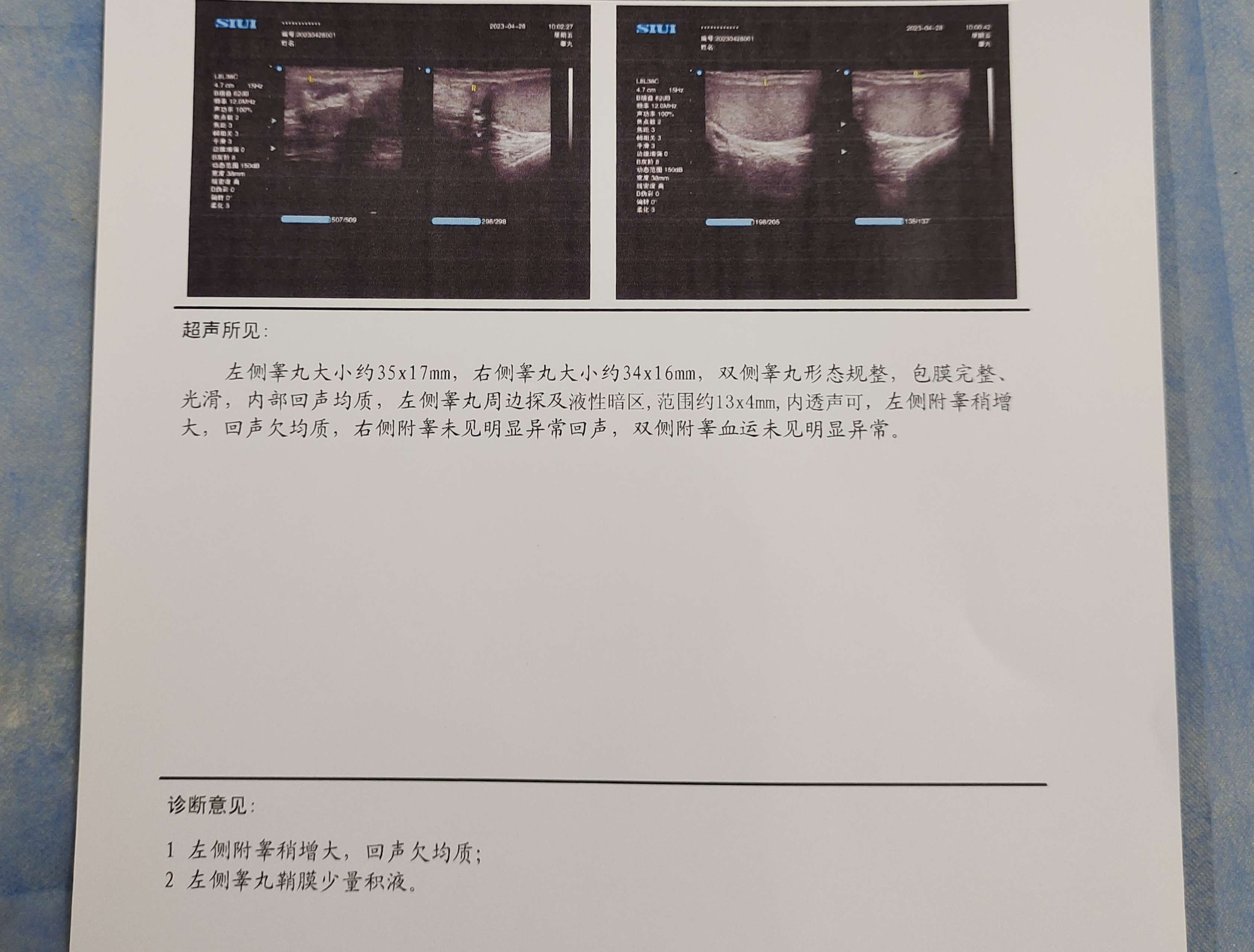 健康 的想法: 慢性附睾炎和睾丸鞘膜少量积液吃中药调理