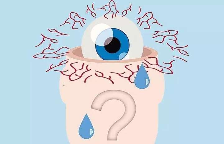 眼睛干涩疲劳发胀一招缓解干眼比眼药水管用
