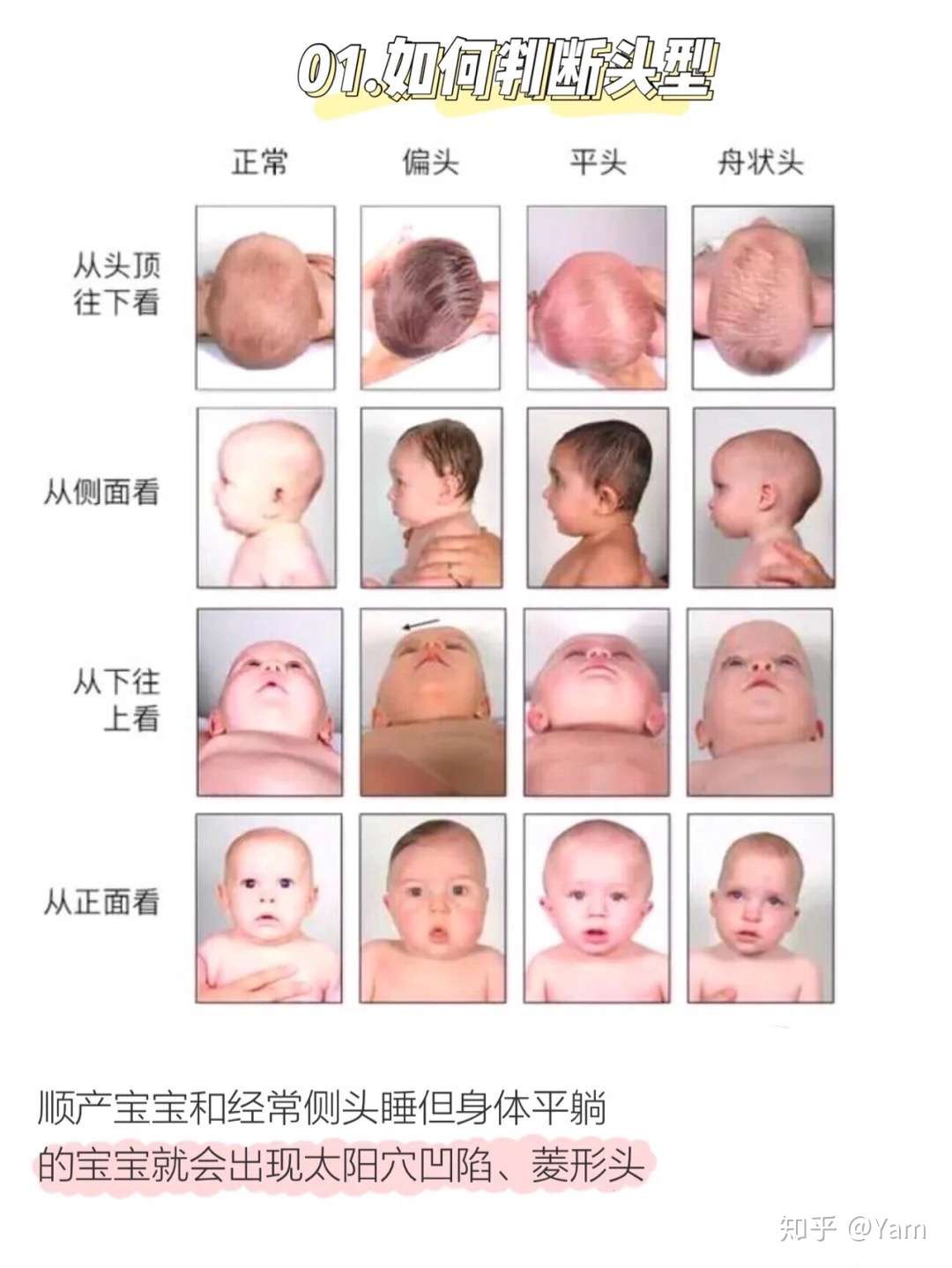 漂亮宝宝三个月睡出圆头 拯救颜值 知乎