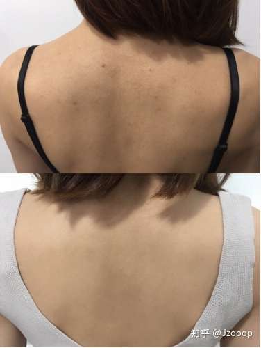 后背一个人怎么抹身体乳(一个人怎么给背上涂身体乳)