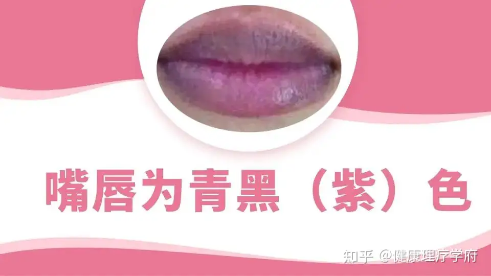 中医怎么从唇色 读 身体的 唇诊教学 知乎