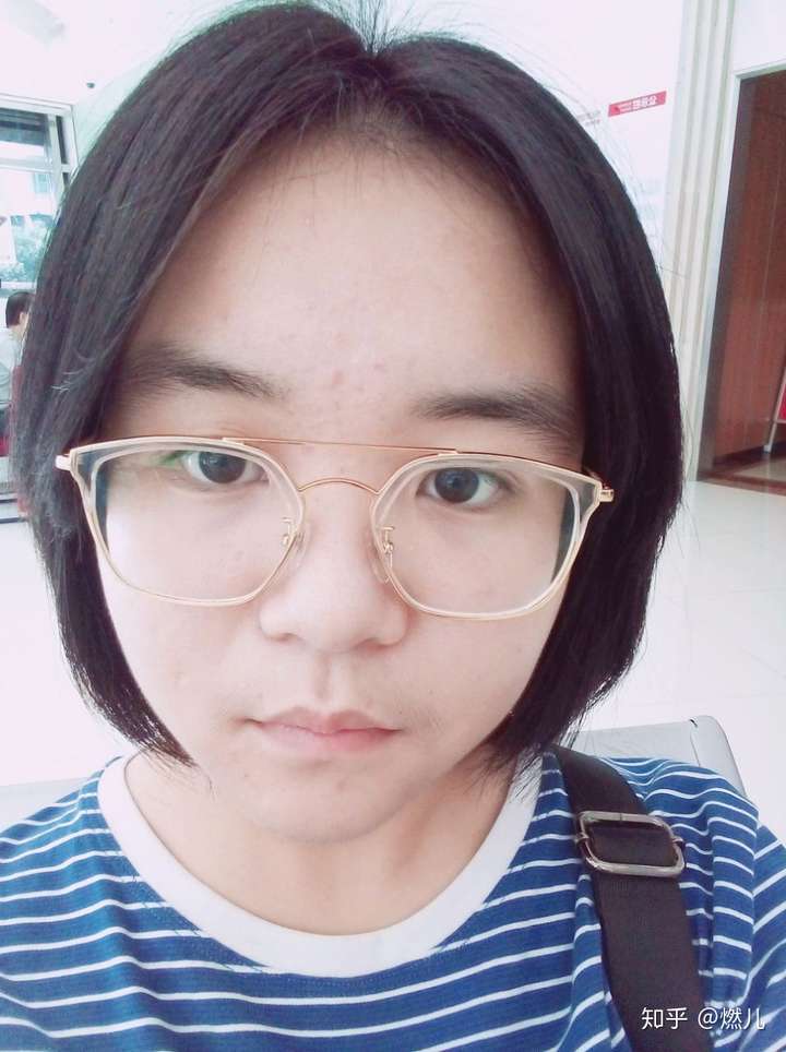 脸圆鼻子塌的女生适合剪短发吗?