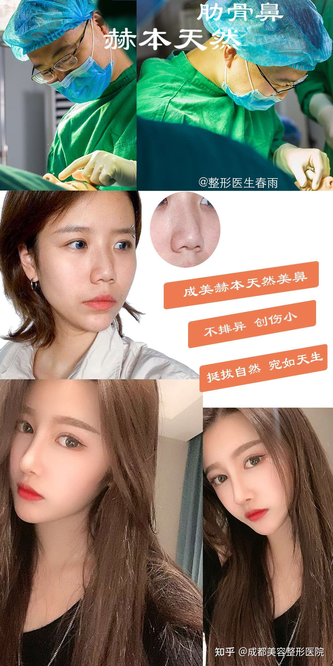 隆鼻失败的原因有哪些 知乎