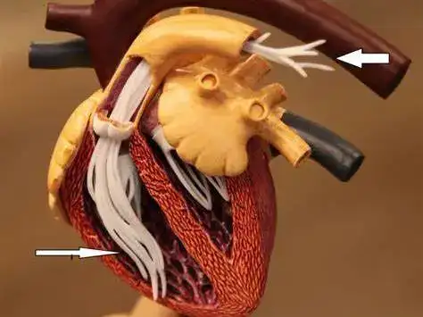 猫咪感染后0症状的心丝虫该如何预防