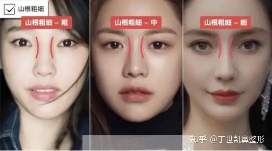 什么是妈生鼻 知乎 什么是妈生鼻 知乎