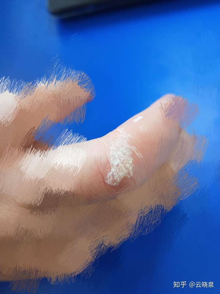 如何看待用双氧水h2o2洗脸美白