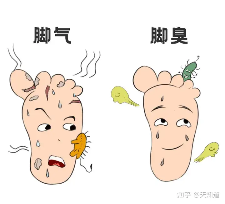 得了脚气脚痒怎么办 - 知乎