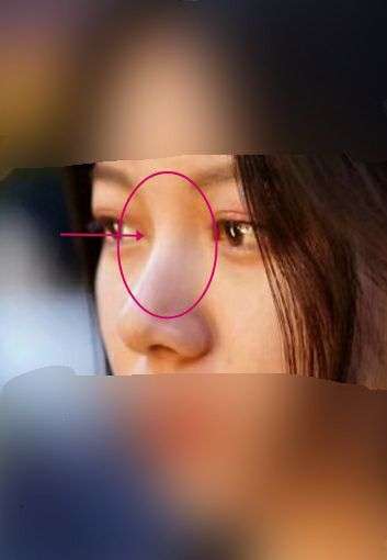 鼻子高但是山根低是什么样?