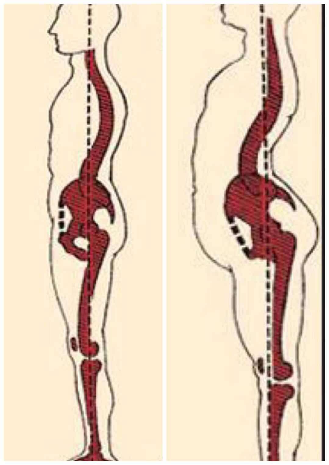 震惊 小腹突出瘦不下去的原因竟然在这里 知乎