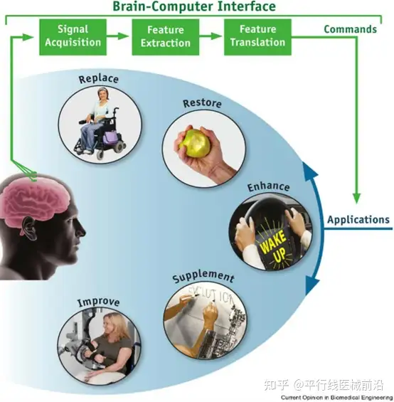 万字长文-侵入式脑机接口公司全面深度解析，BCI离解决真正临床问题还有