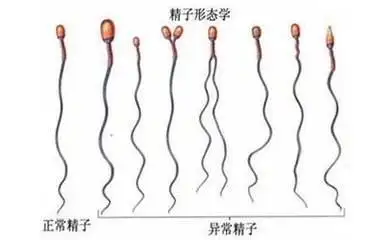 正常精子形态图片