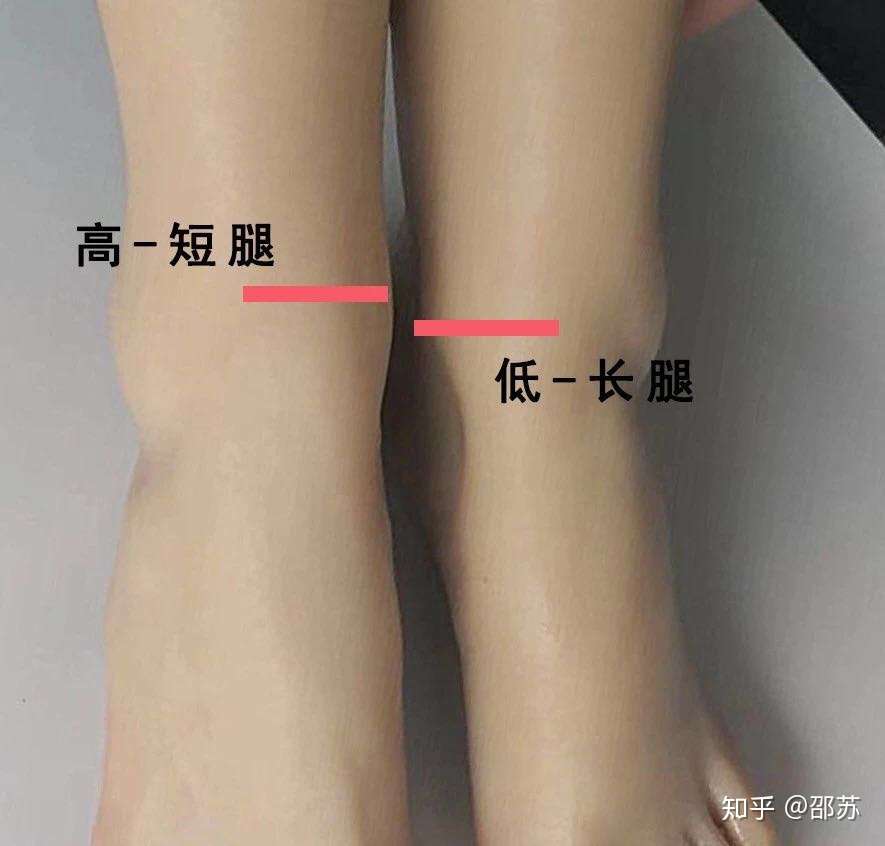 遇到长短腿不用怕 1个动作矫正它 知乎 遇到长短腿不用怕 1个动作矫正它 知乎