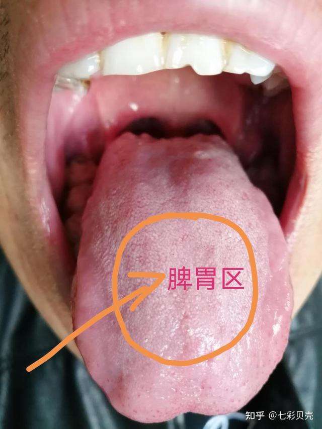 七彩贝壳 的想法: 中医学认为,舌头与脏腑息息相关,能够了… 