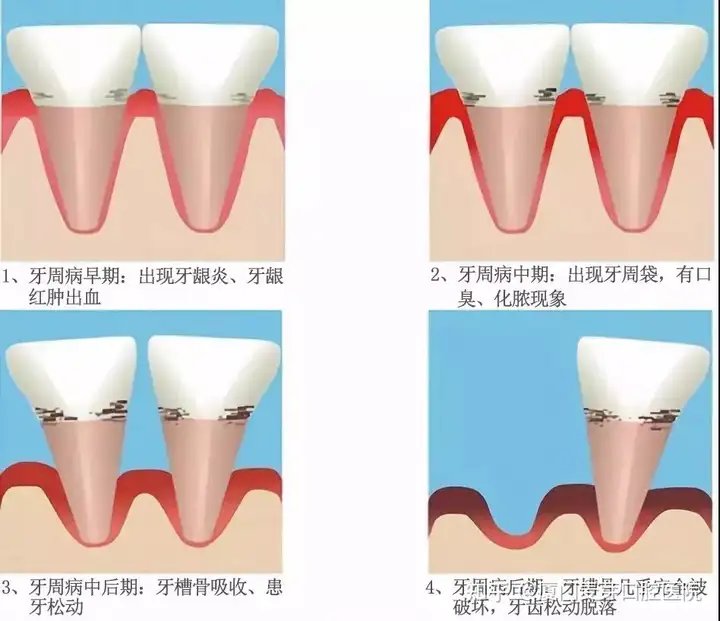 牙时为落缎愈竟俭鼓笆掖僵狞渴(图3)