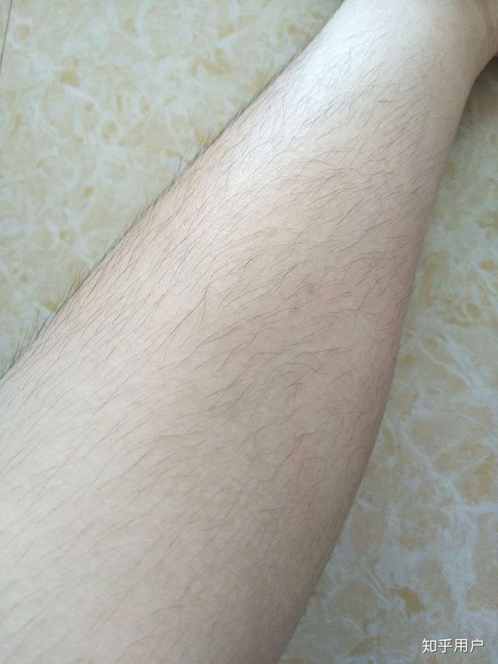女生有腿毛怎么办?