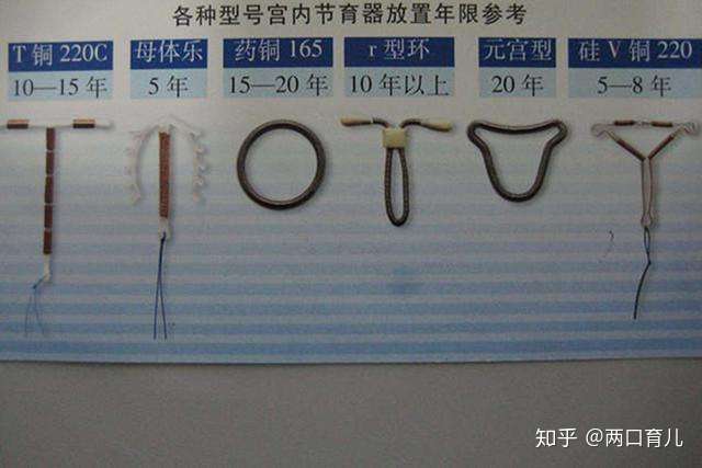 节育环一直在体内对身体有3种伤害劝你赶快取出来